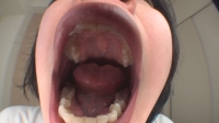 フェチ：リンちゃんの歯・口内自撮り(通常版＋３Ｄ）