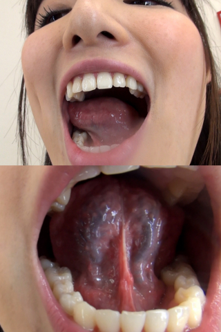 夏樹ちゃんの舌・口内自撮り（通常版＋３Ｄ）